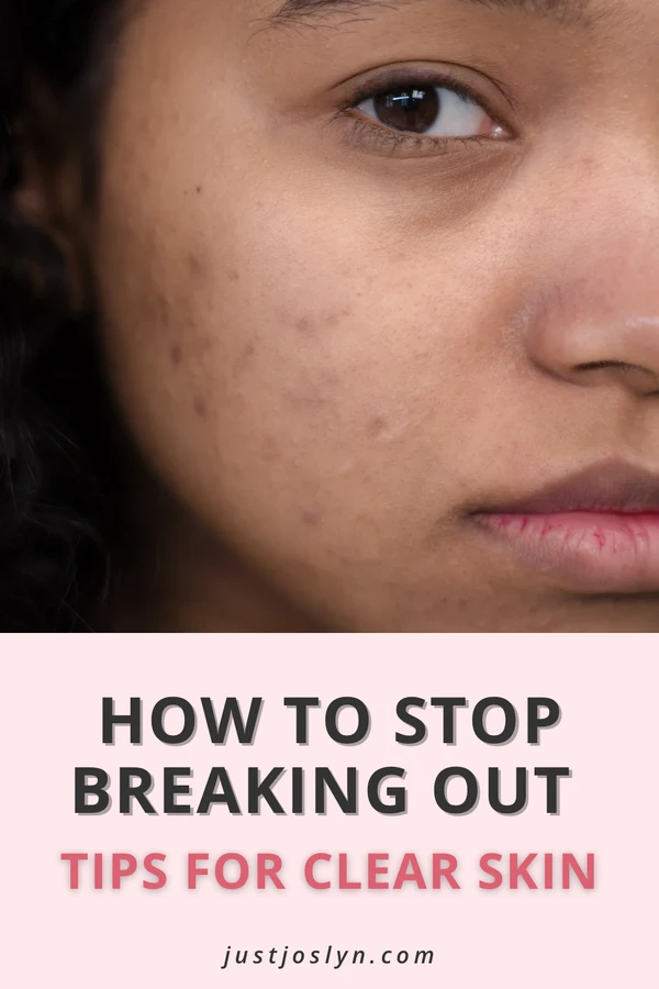 Pinterest pin about How To Stop Breaking Out