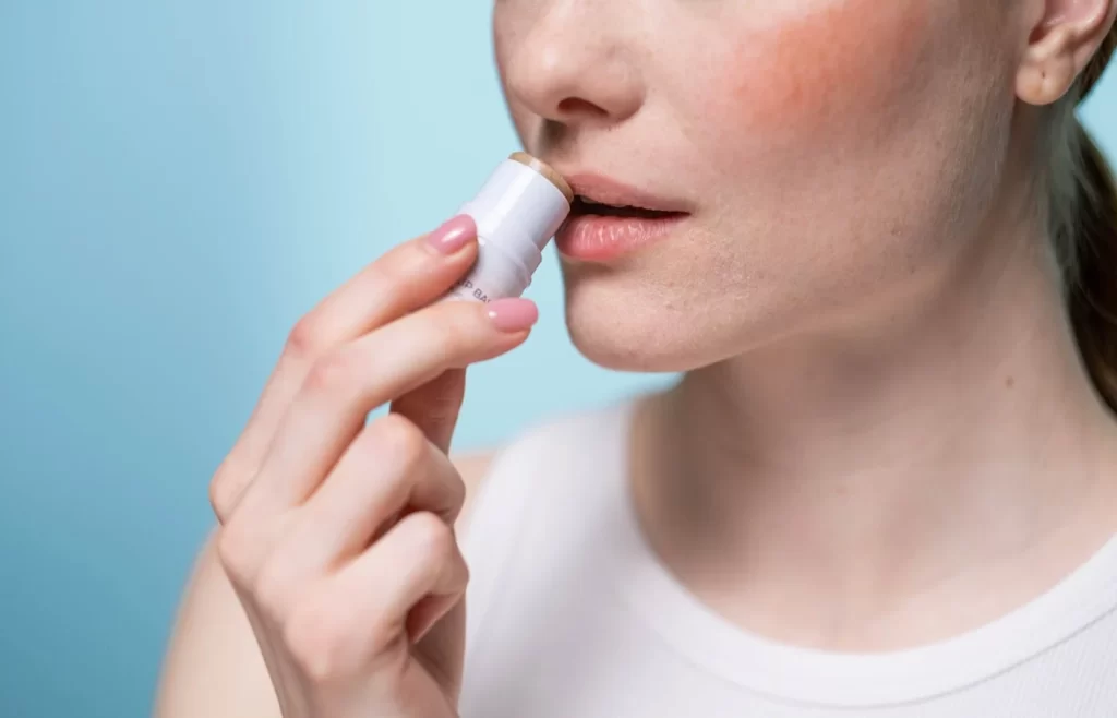 Woman using a lip balm.- Best Lip Balms for Dry Lips