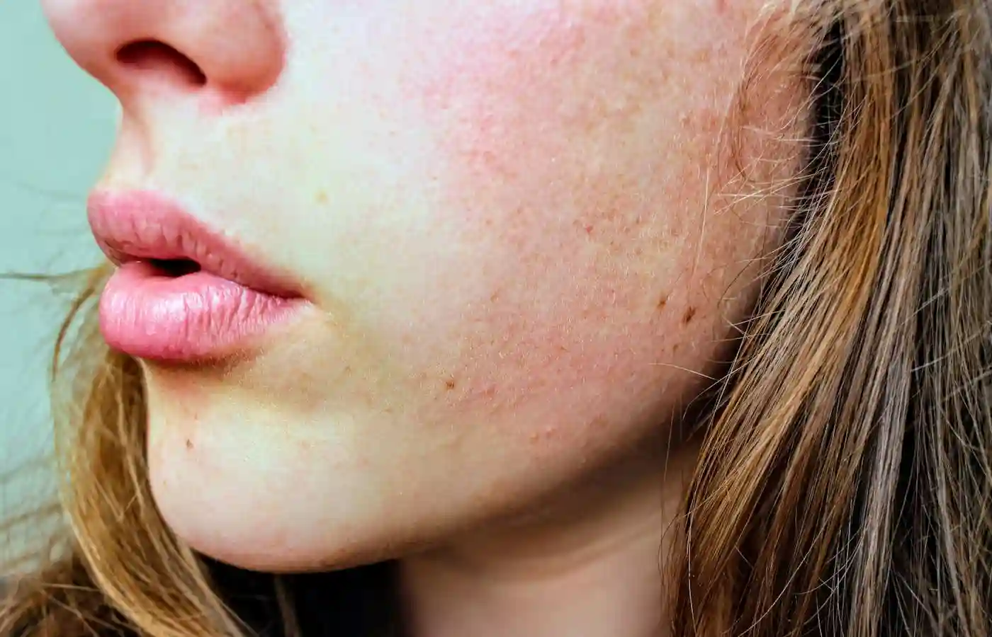 Close view of woman's face. - How To Repair Damaged Skin Barrier