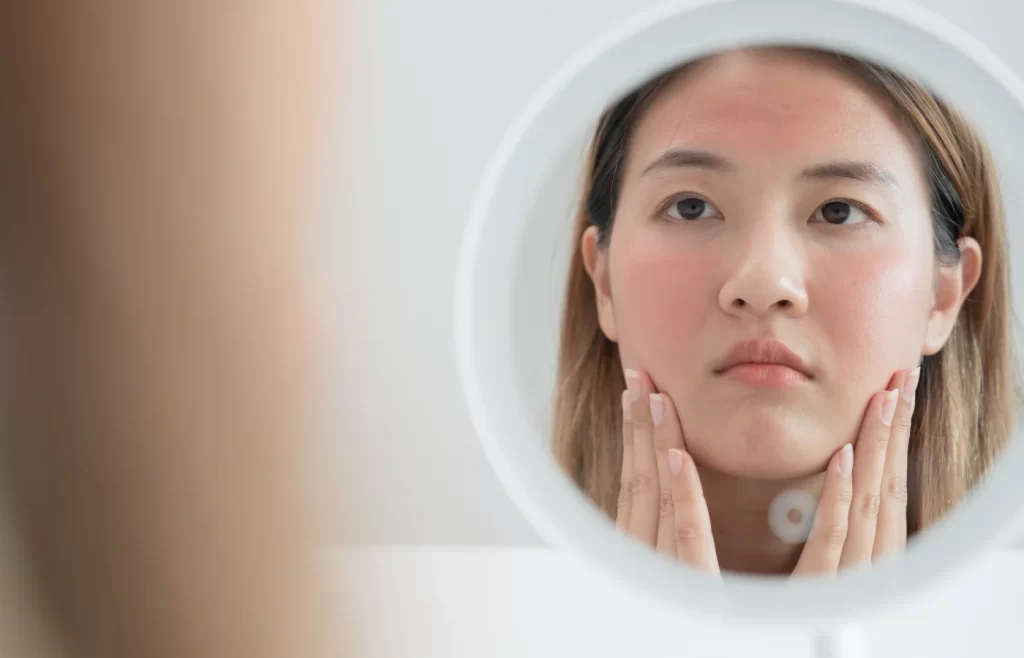 Woman with irritated dry skin - How To Repair Damaged Skin Barrier