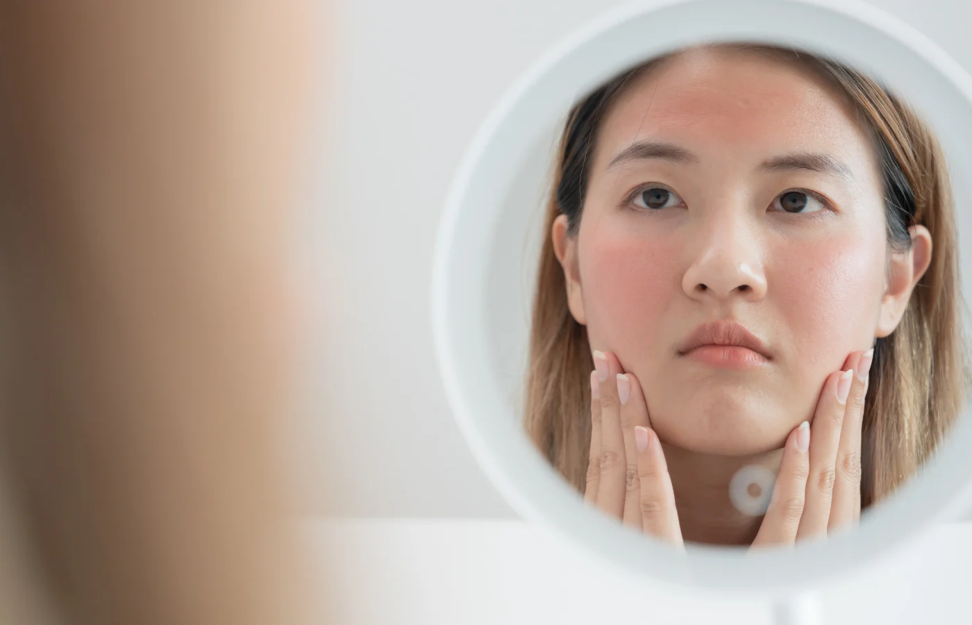 Woman with irritated dry skin - How To Repair Damaged Skin Barrier