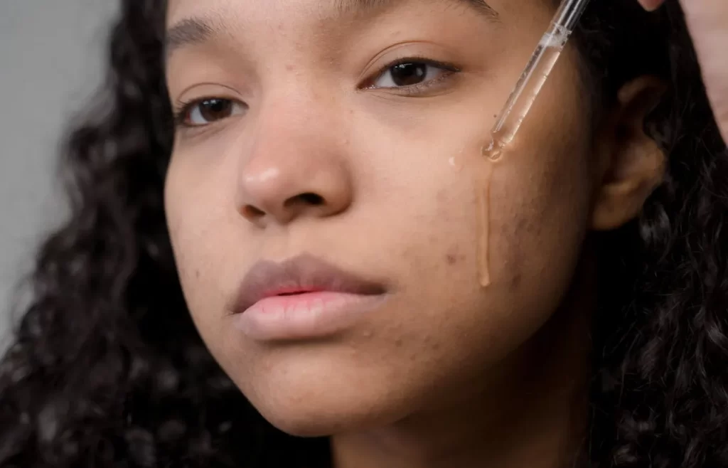 Woman applying serum on face -Skincare Routine for Hyperpigmentation